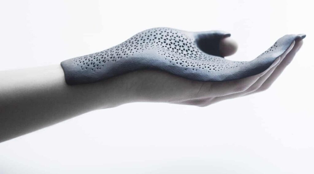 Windform Orthotics